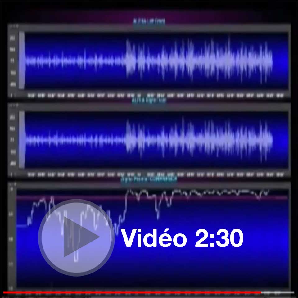Présentation Électro encéphalogramme de la cohérence cérébrale durant la pratique de la Méditation Transcendantale